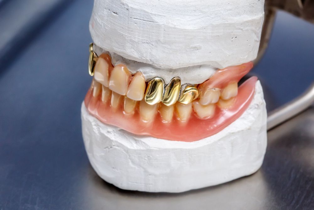 Why Are There Gold Plated Medical Devices?